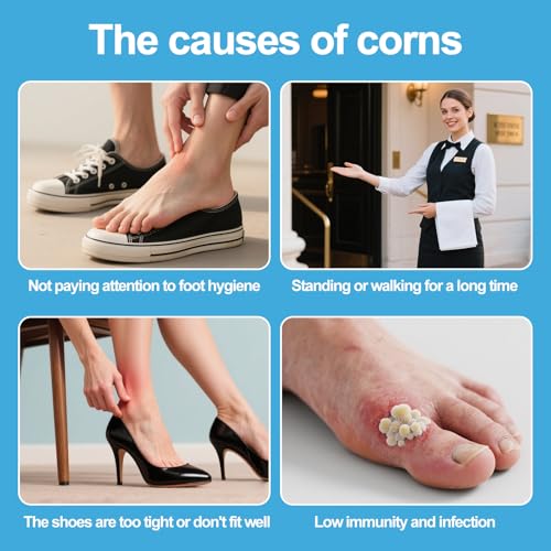 Image of Corn Remover Pads (48 count 2 pack) Plantar Wart Remover for Feet, Corn Removers for Toes with 40% Salicylic Acid, Callus Removal for Feet