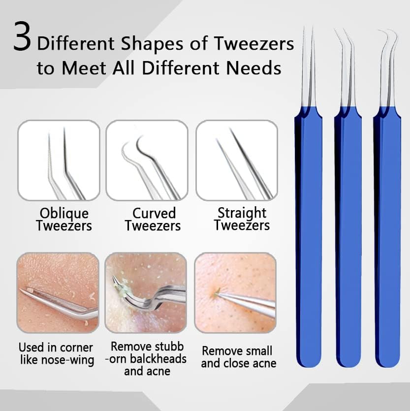 Xesscare Latest Pimple Popper Tool Kit, 16 Pcs Blackhead Remover Tool, Comedone Extractor Acne Removal Kit, Professional Whitehead Tweezers with Metal Case for Facial, Nose and Forehead (Blue)