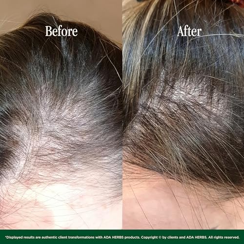 Skin-Hair-Care-100-Natural-Pre-ShowerOvernight-Hair-Oil-Mask-Hair-Treatment-Cold-Pressed-Oils-Vit-E-Squalane-from-Olive-845-Fl-Oz