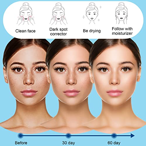 Kastu Facial Serum Essence,Dark Spot Corrector Remover For Face,Whiteseed Brightening Serum Formulated With Vitamin C,Lactic Acid And Salicylic Acid thumb #3