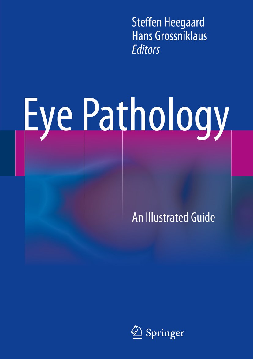 Eye Pathology: An Illustrated Guide (English Edition)