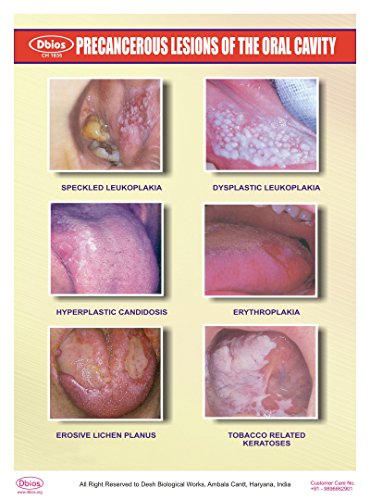 Grafici Dbios Stampa digitale precancerosa lesioni...