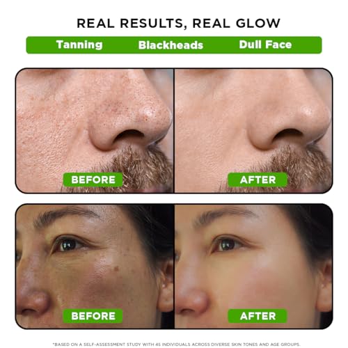 Image of Orgatre Detan Peel Off Face Mask For Glowing Skin | Removes Tan and Minimize Pores | Active Cooling Effect | Enriched with Kojic Acid, Lactic Acid, Glycolic Acid & Bamboo Charcoal (100ml)