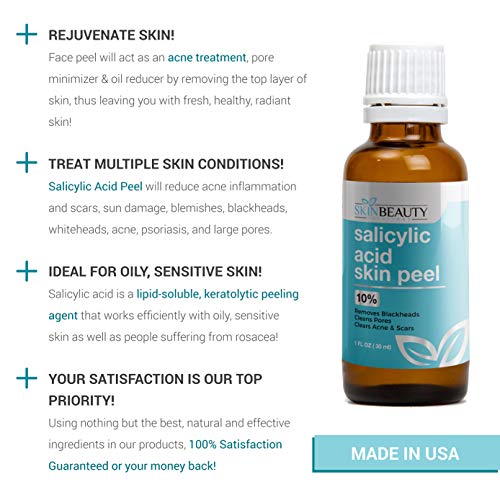 SALICYLIC Acid Peel 20% Chemical Peel with Beta Hydroxy BHA For Rosacea, Acne, Oily Skin, Blackheads, Whiteheads, Clogged Pores, Seborrheic Keratosis, Wart Remover, Dandruff, (1 oz /30 ml)
