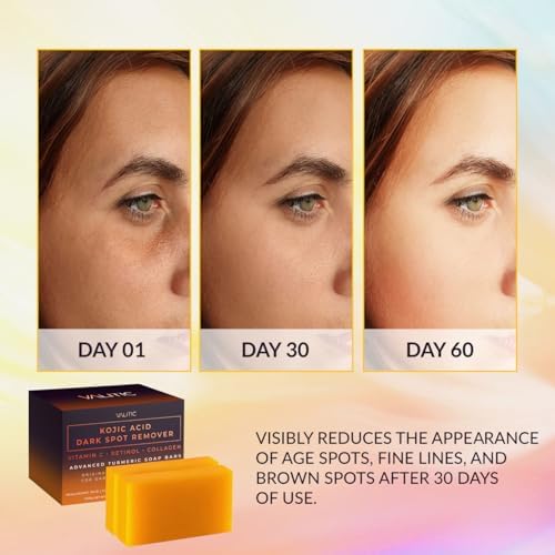 VALITIC Kojic Acid Dark Spot Remover Soap Bars with Vitamin C, Retinol, Collagen, Turmeric - Original Japanese Complex Infused with Hyaluronic Acid, Vitamin E, Shea Butter, Castile Olive Oil (2 Pack) - 1