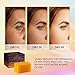 VALITIC Kojic Acid Dark Spot Remover Soap Bars with Vitamin C, Retinol, Collagen, Turmeric - Original Japanese Complex Infused with Hyaluronic Acid, Vitamin E, Shea Butter, Castile Olive Oil (2 Pack)
