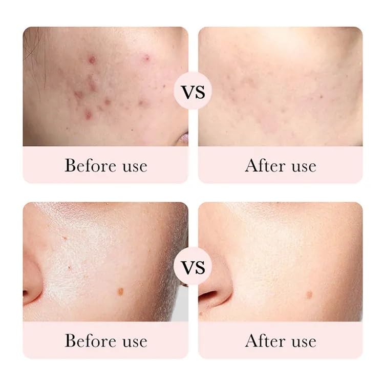 Pure 98% Organic Rose Face Cream with Hyaluronic Acid 50g - Image 4