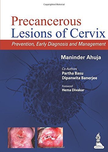 Amazon.in: Buy Precancerous Lesions of Cervix: Prevention, Early ...