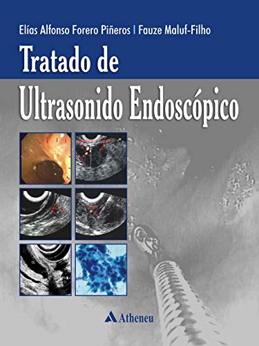 Tratado de ultrasonido endoscópico: