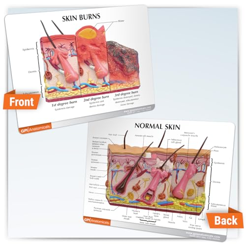 Image of GPI Anatomicals Skin Burn Model, Cross-Section Model Showing Burnt Skin | Human Body and Anatomy Replica for Physiology Education, Anatomical Model for Doctor's Office, Medical Learning Resources