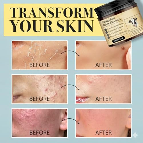 Beef Tallow Honey Balm for Sensitive Skin: Grass-Fed Whipped Tallow Moisturizer with Manuka Honey, Olive Oil, Jojoba Oil & Vitamin E, Non-Greasy Face and Body Cream for Daily Moisture, 2 oz - Image 5