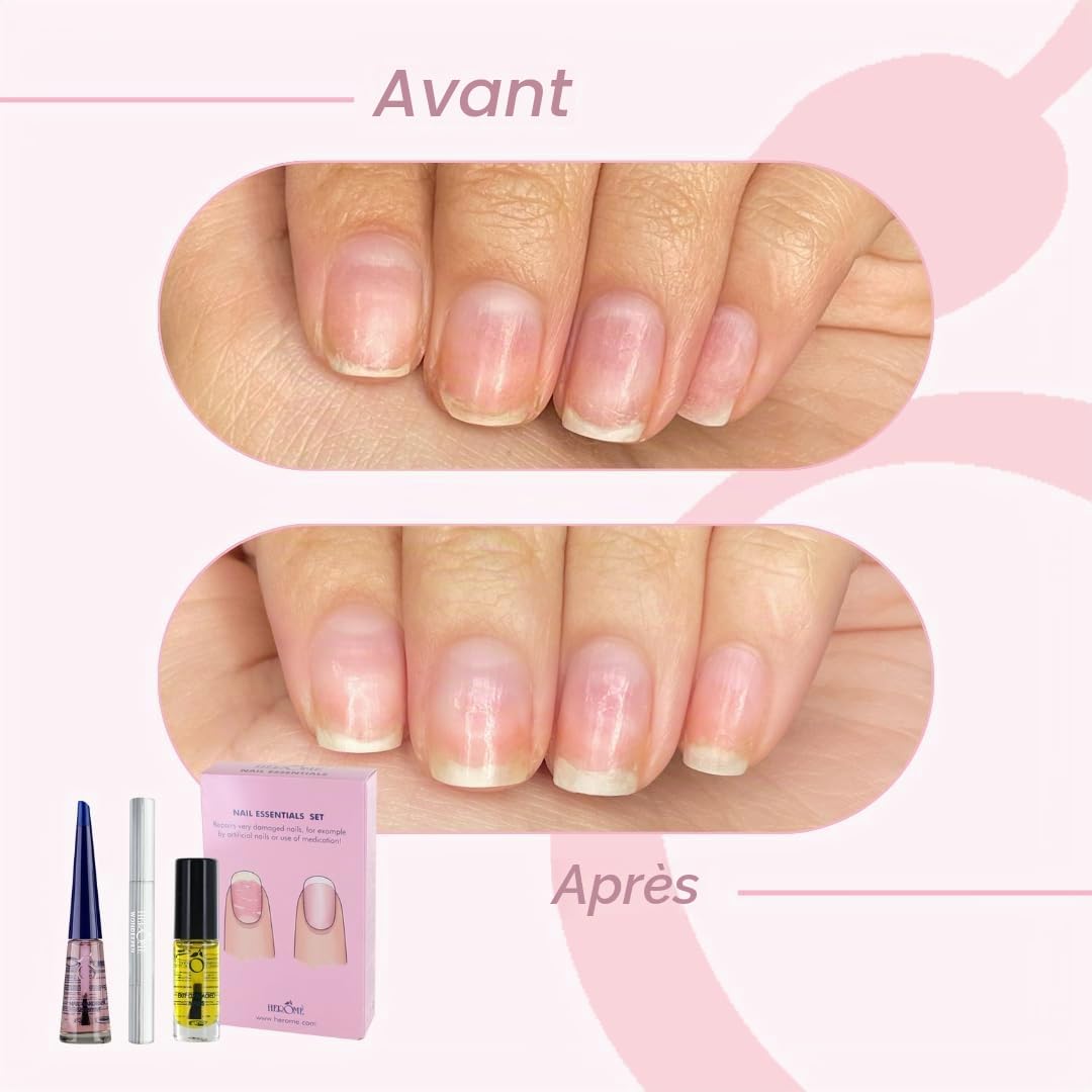 Herome 2-Pack 3-en-1 Nail Essentials Set (Rose) - Travel Set - Soin Réparateur pour les Ongles Cassés - Kit Avec Huile pour Ongles Abîmés, Sérum pour Cuticules et Durcisseur pour Ongles