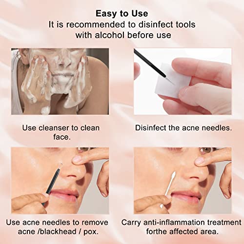 Blackhead Remover Tools, Pimple Extractor, Black Head Extractions Tool For Facefacial Tools Removal Kit For Blemish, Whitehead Popping, Zit Removing For Nose Face Tools With A Leather Bag (Black) #TOP6