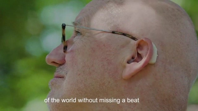 Amazon.co.jp: 【2025年革新型正規品・簡単操作 】Bigprot 充電式集音