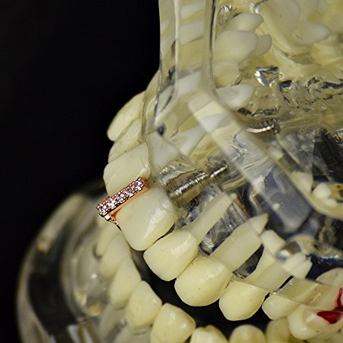 Cz Gap Grillz 14K Rose Gold Plated Cubic Zirconia Bling Tooth Top Or Bottom Teeth Single Cap Hip Hop Grills #TOP3