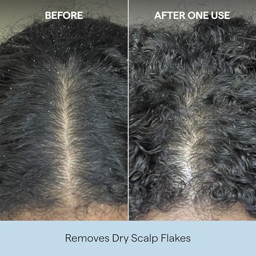 Image of Briogeo Scalp Revival Charcoal + Coconut Oil Micro-Exfoliating Shampoo | Sulfate-Free Scalp Scrub for Dry, Itchy, or Oily Scalp | Detoxifying & Hydrating | Vegan & Cruelty Free