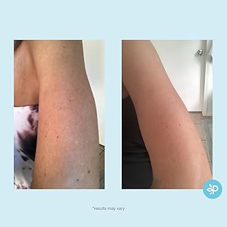 Perfect Image Hydro-Glo 10% Daily Use Peel Pads Enhanced with Lactic Acid, Mandelic Acid, Glutathione, Kojic Acid, Licorice, Papaya, Pineapple, Bearberry Extracts -