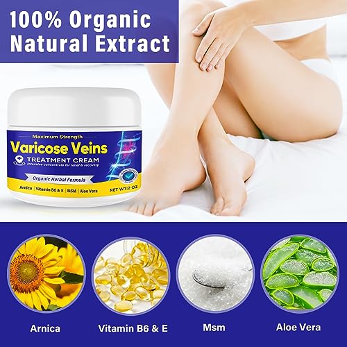 Sovob Varicose Veins Treatment For Legs, Varicose Veins Cream Natural Treatment For Improve Blood Circulation Relieve Leg Swelling & Fatigue Relief thumb #3