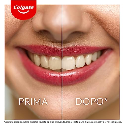 Colgate Dentifricio Sbiancante Max White Ultra Active Foam 50 ml I Denti Più Bianchi in Soli 3 Giorni * I Azione Ossigenata ad Assorbimento Profondo I Clinicamente Testato I Sbiancamento denti