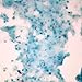 Mycobacterium Tuberculosis, w.m. Microscope Slide