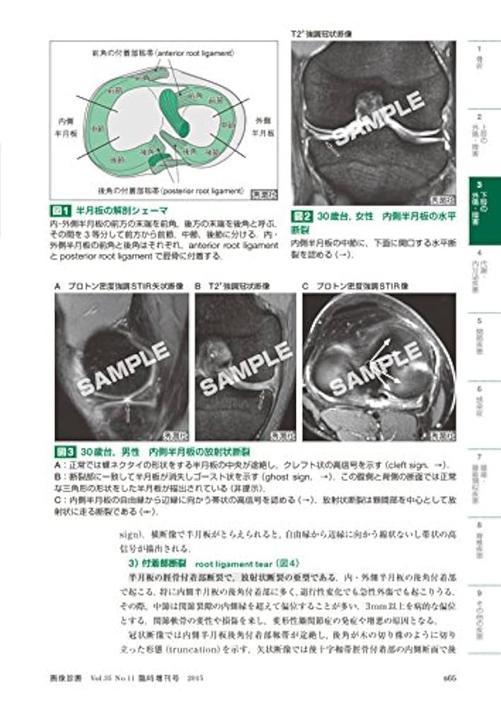 ステップアップのための骨軟部画像診断 Ｑ＆Ａアプロ-チ  /学研メディカル秀潤社/福田国彦（単行本） ステップアップのための骨軟部画像診断 Q&Aアプローチ_画像診断