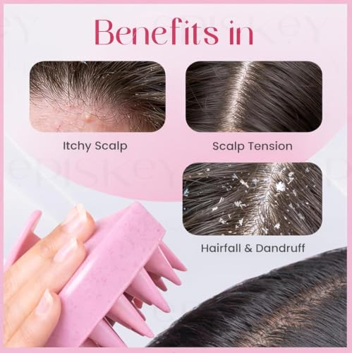 Image of Episkey Scalp Massager Shampoo Brush for Hair Wash Anti-Dandruff Silicone Scalp Scrubber with Soft Bristles | Deep Clean, Exfoliation & Hair Growth Ayurvedic Head Massage Brush for Men&Women(JP-35) (PACK 2)