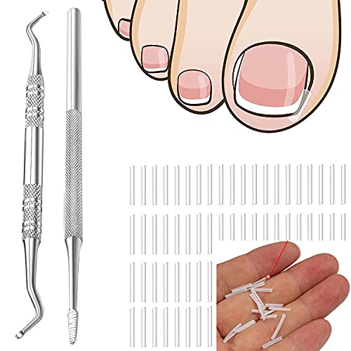 Ingrown Toenail Tools, Professional Ingrown Toenail Correction Kit Contain Ingrown Toenail File and Lifter, with Ingrown Toenail Recover Clips Corrector 50Pcs