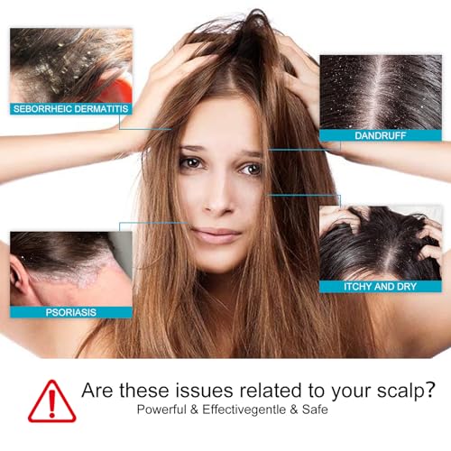 Dry Scalp Shampoo Folliculitis Shampoo, Seborrheic Dermatitis Shampoo, Anti Dandruff Shampoo, Folliculitis Treatment, Dandruff Treatment, with Herbal Essence to Hydrate Hair, Relieve From Itchy - Image 3