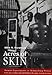 Acres of Skin: Human Experiments at Holmesburg Prison