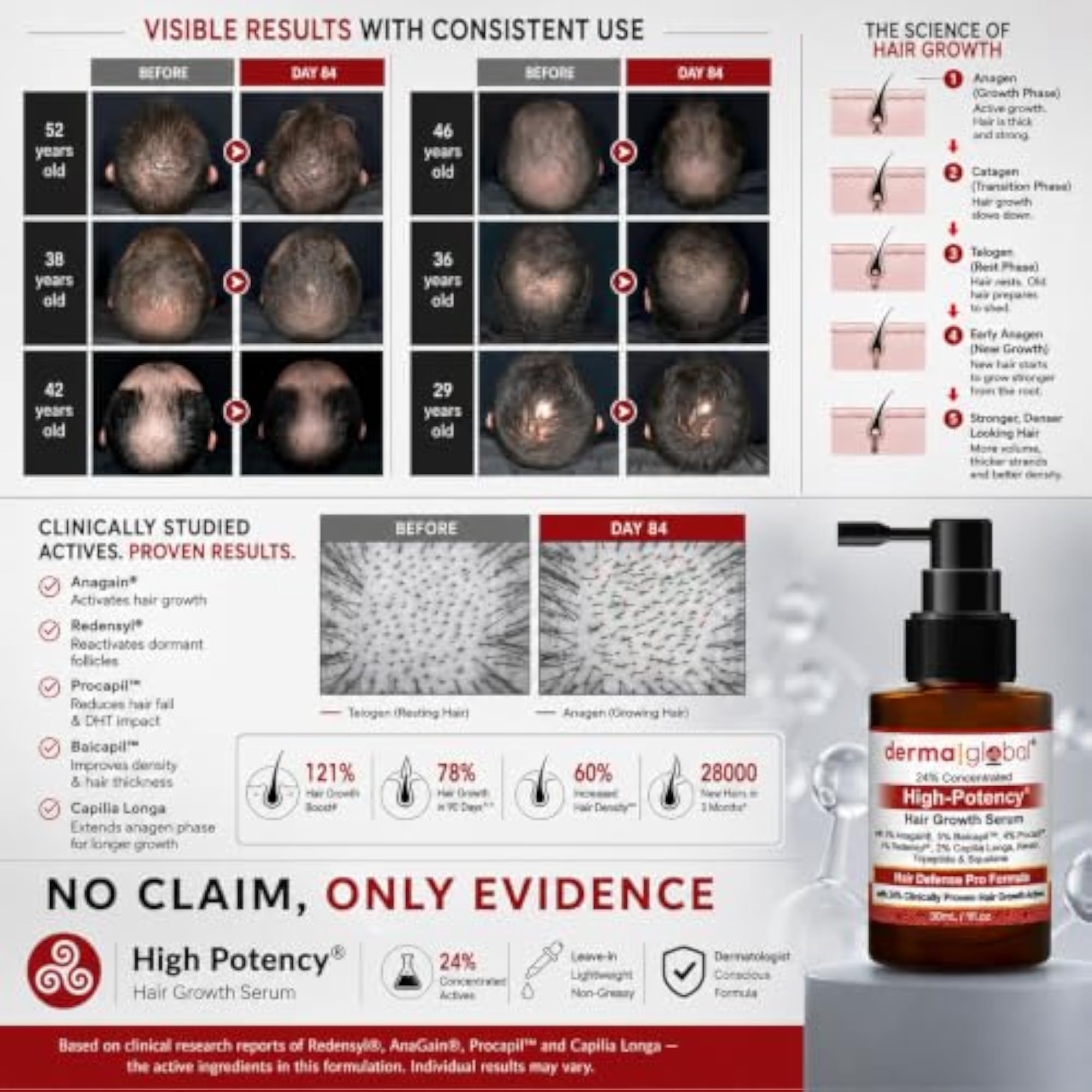 High Potency® Hair Growth Serum, 24% Actives with Anagain