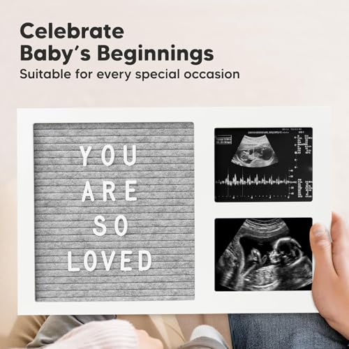 Image of a baby cherry - Baby Picture Frame with Announcement Message Felt Board & Letterboard Letters | My First Year Picture | Ultrasound Picture Frame | white