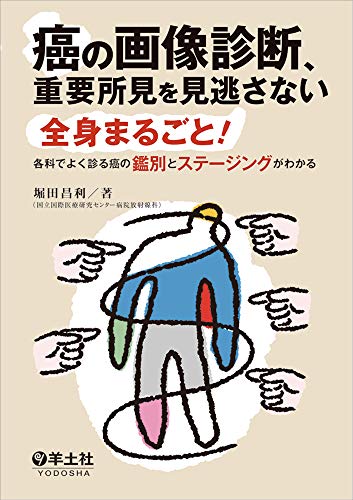 楽天 無料電子書籍 癌の画像診断、重要所見を見逃さない〜全身まるごと! 各科でよく診る癌 バイ