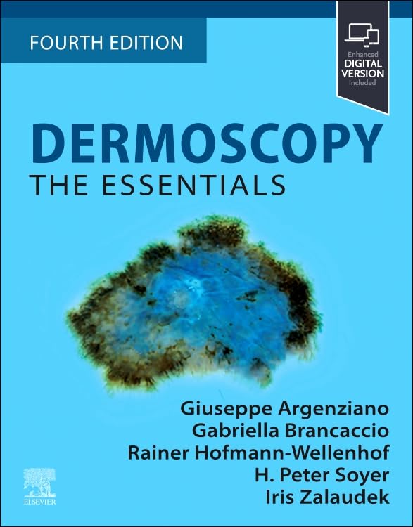 Dermoscopy: The Essentials: The Essentials