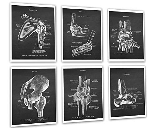 Medical Decor Set Of 6 Unframed Orthopedic Posters Of Human Anatomy Joints #TOP14