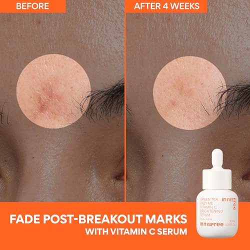 Image of innisfree Daily UV Defense SPF 50+ PA++++ Korean Face & Body Sunscreen, Broad Spectrum, Invisible Finish, No White Cast, Lightweight, Hydrating