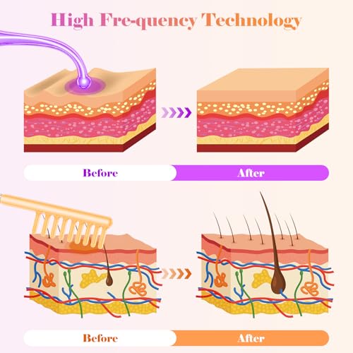 High F-requency Wand, iklestar High F-requency Facial Machine for Hair Growth with 6 Glass Tubes, Handheld Hair Wand Kit for Home Use - Image 4