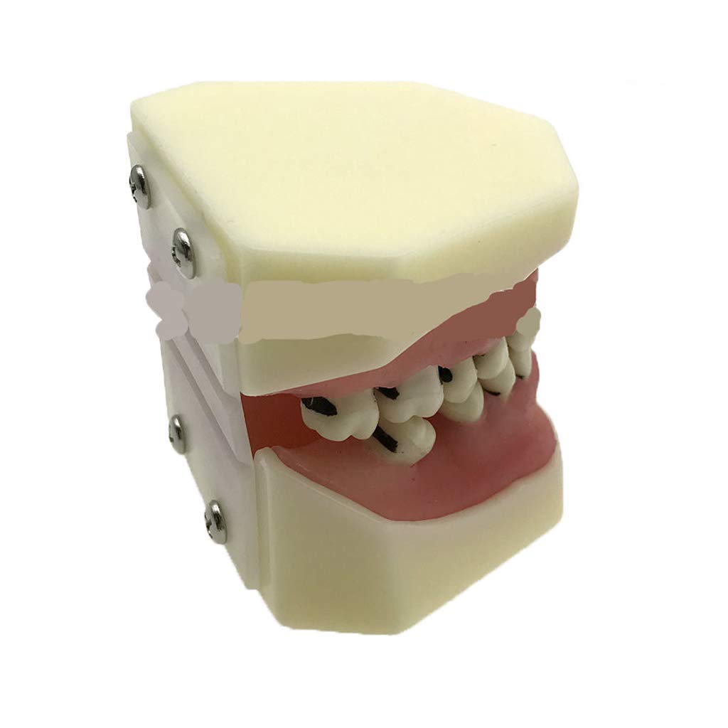 Modello Didattico di Denti Standard Ortodontici per Studenti di Odontoiatria Infantile, Modello Anatomico Dentale, Modello Dimostrativo Dentale