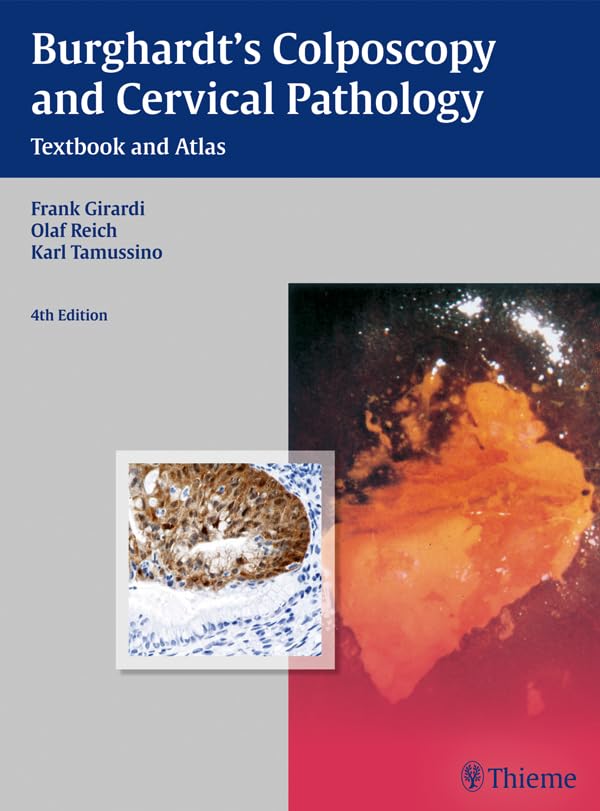 Burghardt's Colposcopy and Cervical Pathology: Textbook and Atlas      4th Edition, Kindle Edition