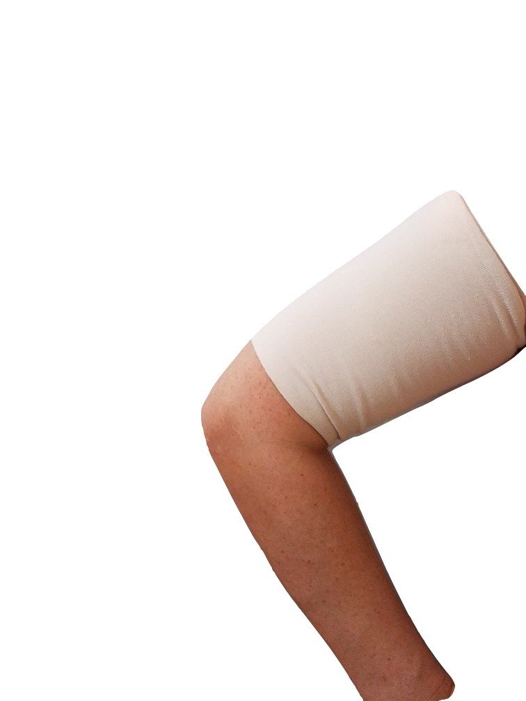 Arm With Dialysis Fistula