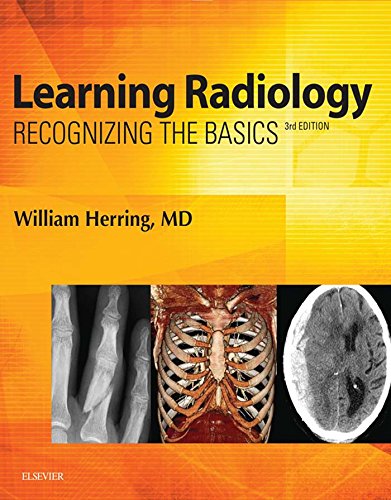 Learning Radiology E-Book: Recognizing the Basics Learning Radiology E-Book: Recognizing the Basics