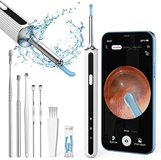 Ear Wax Removal Kit Otoscopes Visual Earwax Removal Camera 1080P FHD WiFi Wireless Ear Cleaner with 6 LED Light for Adults, White
