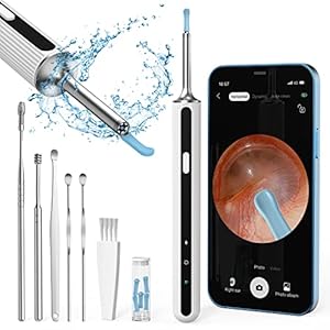 Ear Wax Removal Kit Otoscopes Visual Earwax Removal Camera 1080P FHD WiFi Wireless Ear Cleaner with 6 LED Light for…