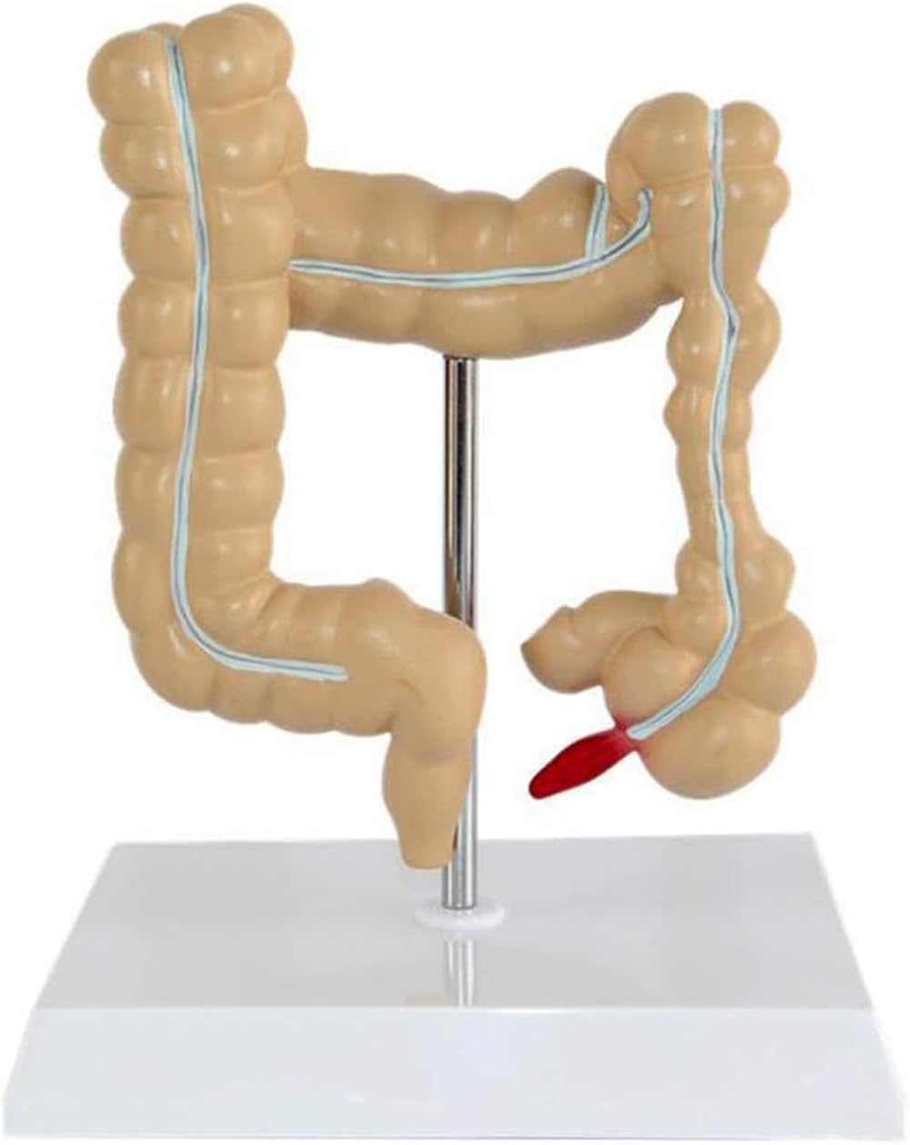 Model patologicznej zmiany jelita grubego człowieka, naturalnie duże narzędzie do nauczania anatomii do edukacji medycznej i treningu klinicznego