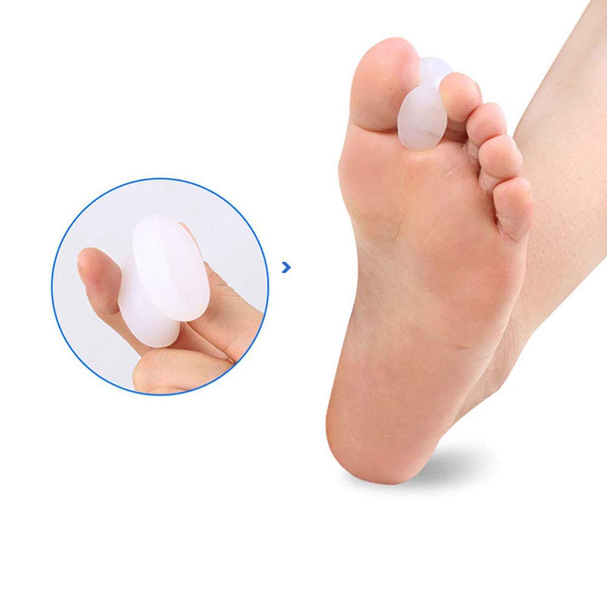 Pedimend, separatore in gel di silicone per alluce valgo (4 paia, 8 pezzi), separatori per alluce valgo, raddrizzante, raddrizza le dita sovrapposte e corretto allineamento, previene e tratta alluce