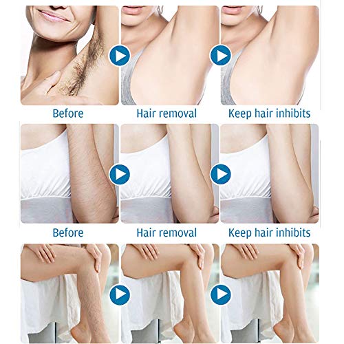 image for Shaboo Prints Hair Removal Spray Hair Inhibitor, Painless Hair Stop Gr