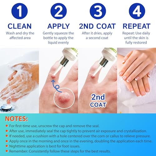 Image of Ulensy Corn Remover Liquid for Toes Feet: 20ml Salicylic Acid for Foot Corns Calluses Wart Removal at Work Home - Safe for Kids Teens Adults Seniors Athletes Runners Workers Men Women