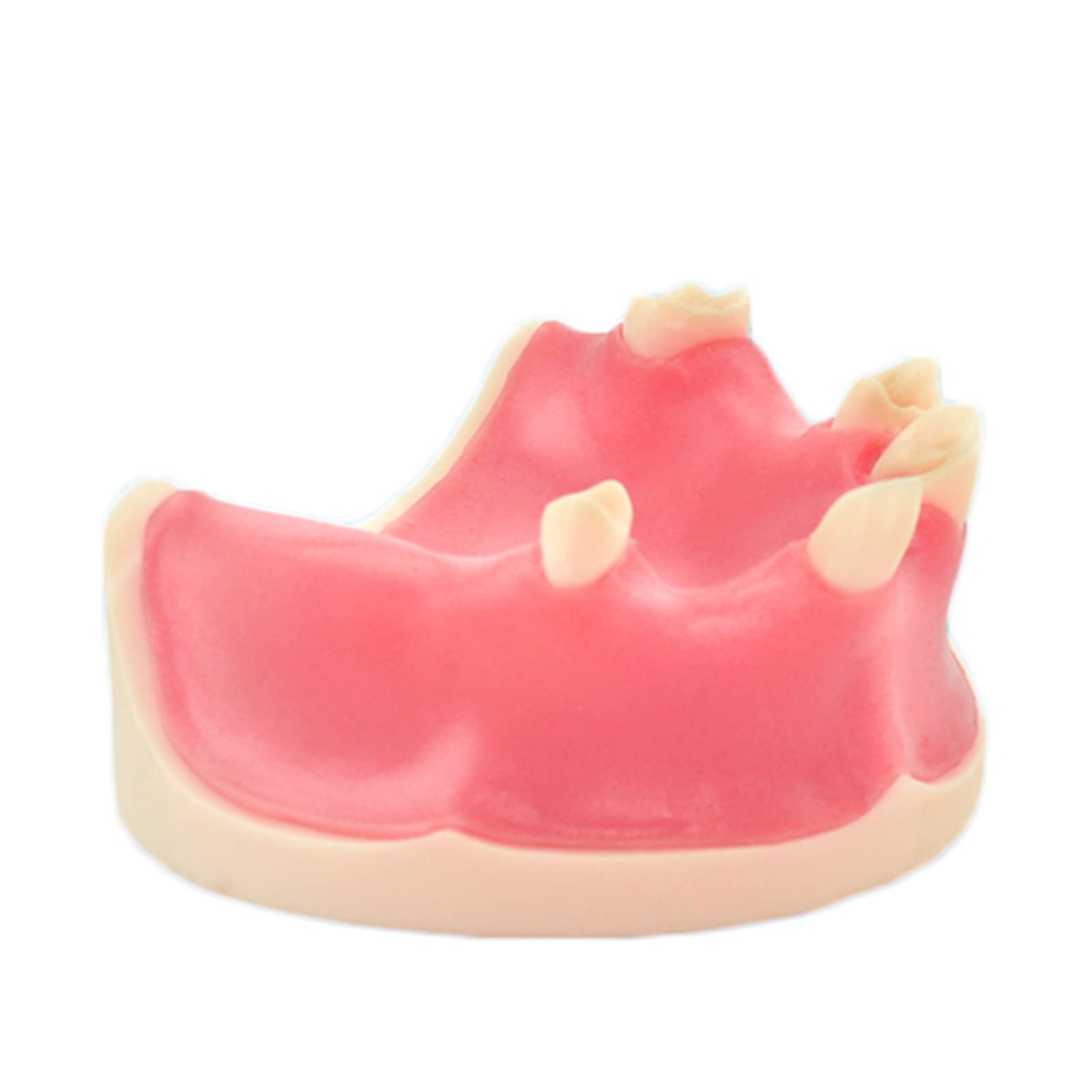 Modello di impianto Dentale mascellare - Modello di Studio Modello di Denti per Adulti - Modello didattico Esercizio di sutura implantare Otturazione mascellare Modello di Imp
