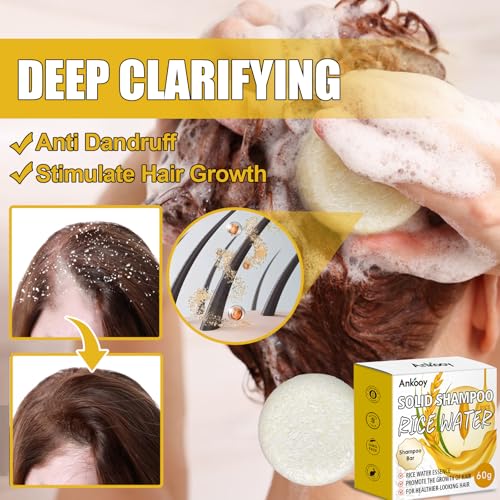 Image of Shampoo Bar,Rice Water for Hair Growth,Clarifying Shampoo for Build Up,Soap Bar,Shampoo for Thinning Hair for Women and Men,Dandruff Shampoo,Frizz Control Hair Care,Travel Shampoo,Sulfate-Free(2 Pack)
