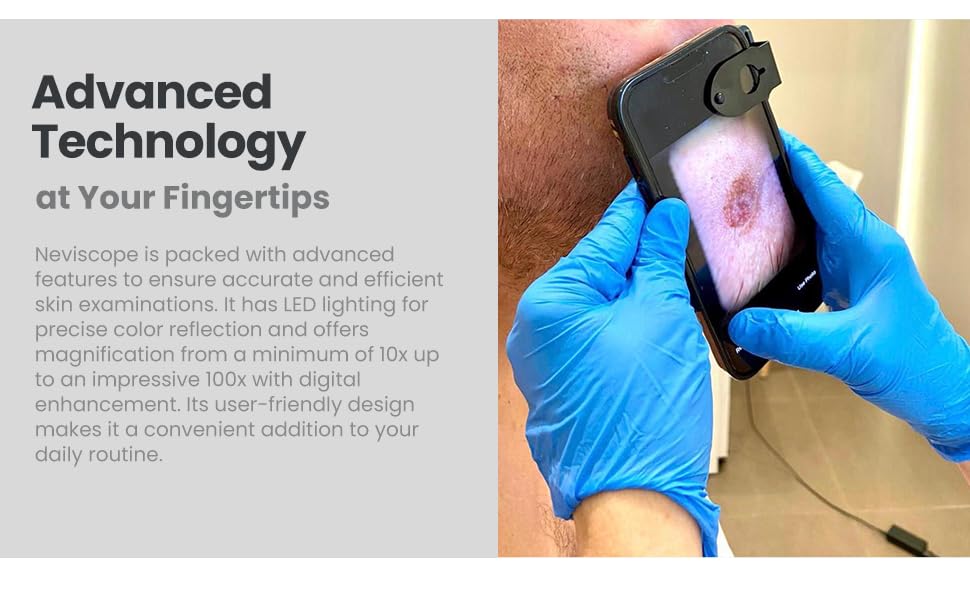Dermatoscope pour téléphone portable Neviscope microscope polarisé iPhone Android clip universel - 5