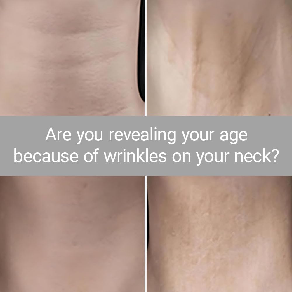Neck-lifting Tape, Invisibled Face Lift Strap - Image 4
